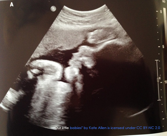 Imaging tests for the NCLEX ultrasound
