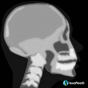 Imaging tests for the NCLEX x-ray
